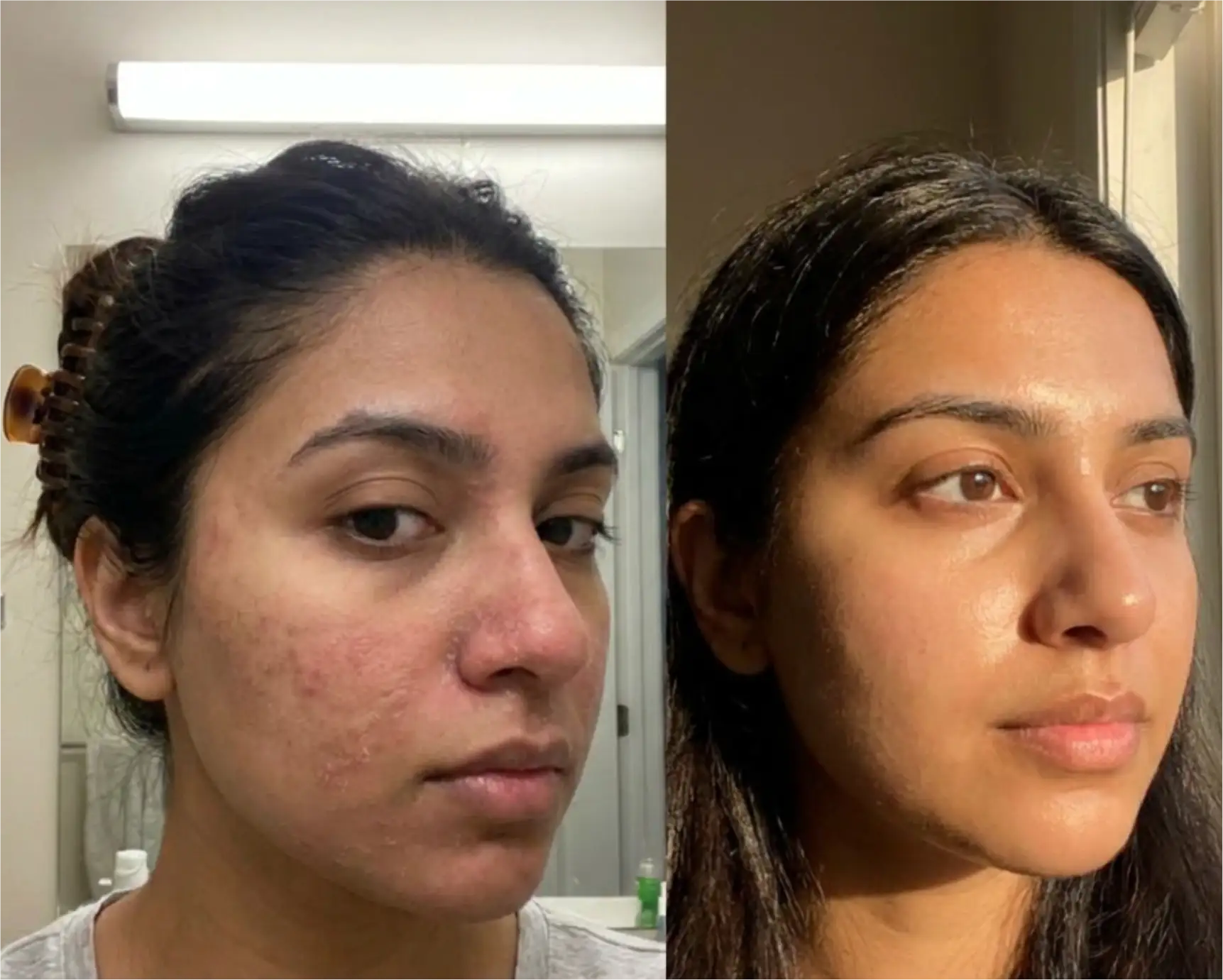 Customer result